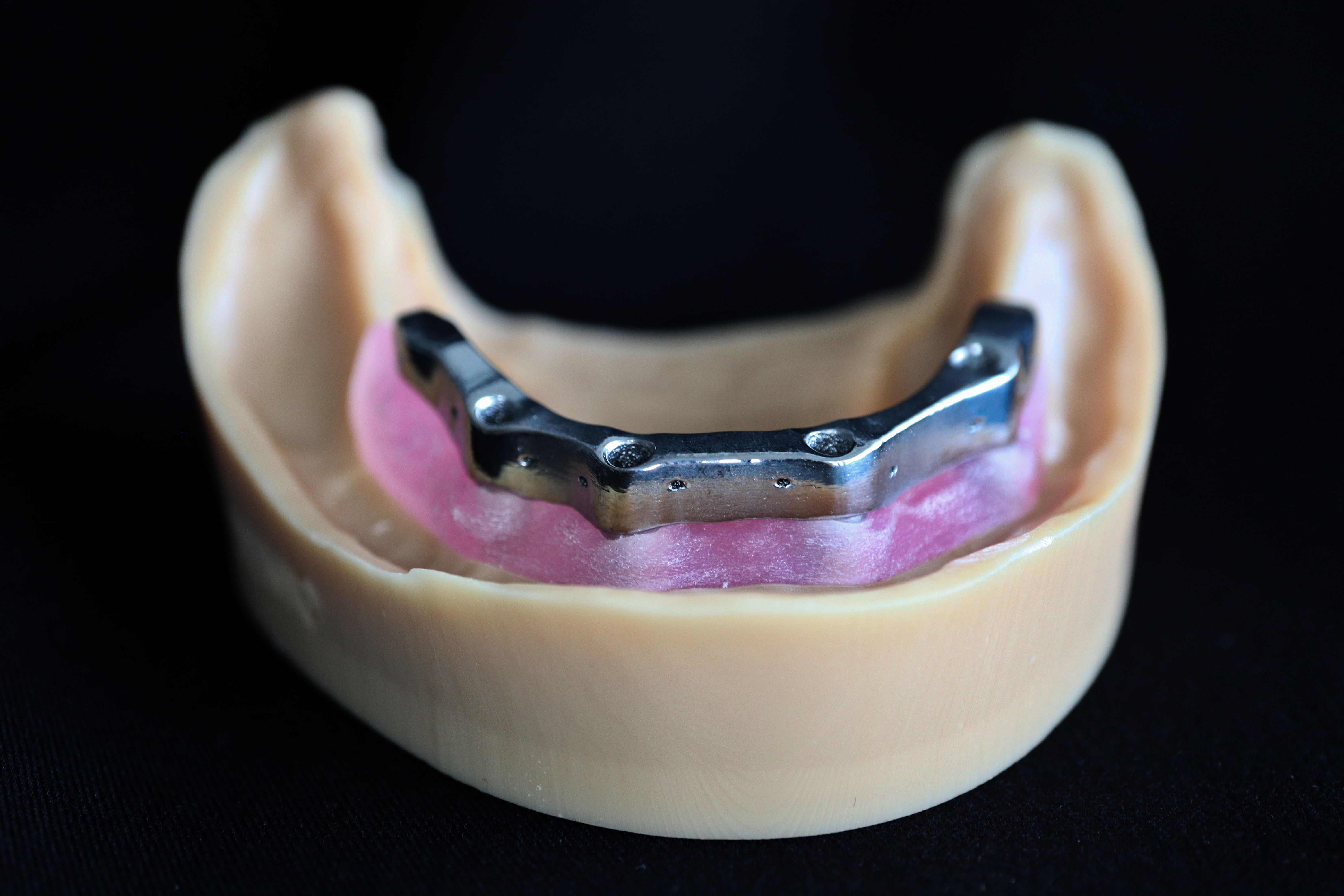 Fig. 4: Final additively manufactured latticed-structured dental implant bar. 